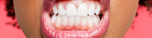 Bright Smile, Strong Gums: How Vitamins Support Oral Health 🦷✨